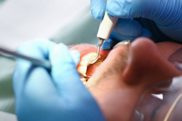 Best Emergency Dental Services Near Me  in Humboldt Hill, CA